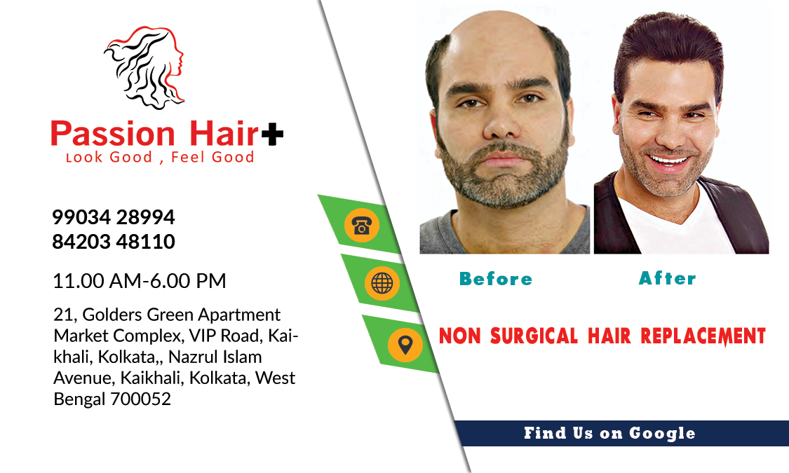 Low Cost Non Surgical Hair Replacement or High Cost Hair Transplant Surgery
